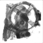 Radiographie du Fragment A.